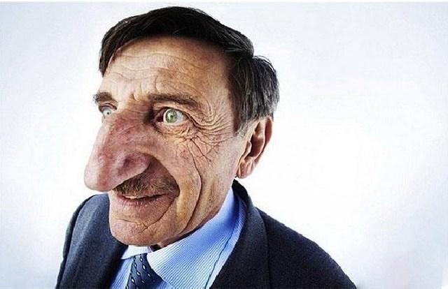 土耳其男子，蝉联世界鼻子最大的人世界上鼻子最大的男人